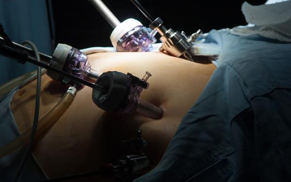 Bariatric surgery. What does a bariatric surgeon do?